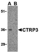 CTRP3 Antibody in Western Blot (WB)