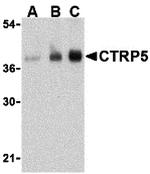 CTRP5 Antibody in Western Blot (WB)