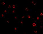 AES Antibody in Immunocytochemistry (ICC/IF)