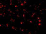 Beclin 1 Antibody in Immunocytochemistry (ICC/IF)