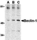 Beclin 1 Antibody in Western Blot (WB)