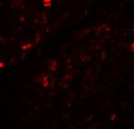 Beclin 1 Antibody in Immunohistochemistry (IHC)