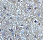 Beclin 1 Antibody in Immunohistochemistry (IHC)