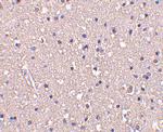 CRMP1 Antibody in Immunohistochemistry (IHC)