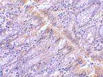 PIST Antibody in Immunohistochemistry (IHC)