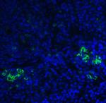 TLR3 Antibody in Immunohistochemistry (IHC)