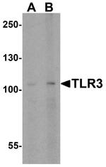 TLR3 Antibody in Western Blot (WB)