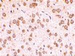 TLR5 Antibody in Immunohistochemistry (IHC)