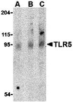 TLR5 Antibody in Western Blot (WB)