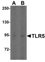 TLR5 Antibody in Western Blot (WB)