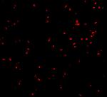 IRE1 alpha Antibody in Immunocytochemistry (ICC/IF)