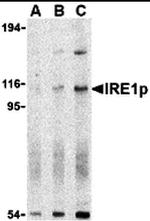 IRE1 alpha Antibody in Western Blot (WB)