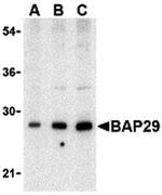 BAP29 Antibody in Western Blot (WB)