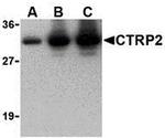 CTRP2 Antibody in Western Blot (WB)