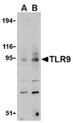 TLR9 Antibody in Western Blot (WB)