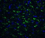 TOLLIP Antibody in Immunohistochemistry (IHC)