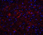 Apolipoprotein J Antibody in Immunohistochemistry (IHC)