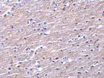 Apolipoprotein J Antibody in Immunohistochemistry (IHC)