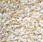 Apolipoprotein J Antibody in Immunohistochemistry (IHC)