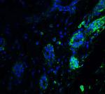 ATF6 Antibody in Immunohistochemistry (IHC)