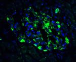 ATF6 Antibody in Immunohistochemistry (IHC)