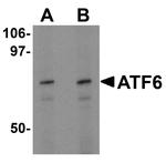 ATF6 Antibody in Western Blot (WB)