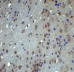 ATF6 Antibody in Immunohistochemistry (Paraffin) (IHC (P))