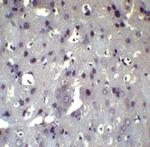 ATF6 Antibody in Immunohistochemistry (Paraffin) (IHC (P))