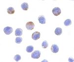 DDX3 Antibody in Immunocytochemistry (ICC/IF)