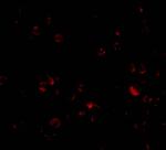 DDX3 Antibody in Immunocytochemistry (ICC/IF)