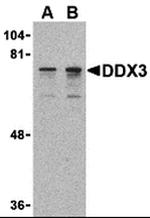 DDX3 Antibody in Western Blot (WB)