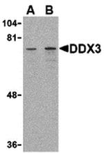 DDX3 Antibody in Western Blot (WB)