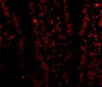 LSD1 Antibody in Immunocytochemistry (ICC/IF)