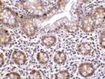 LSD1 Antibody in Immunohistochemistry (Paraffin) (IHC (P))