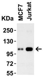 LSD1 Antibody in Western Blot (WB)