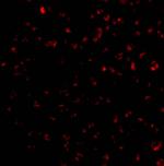 BIK Antibody in Immunocytochemistry (ICC/IF)