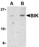 BIK Antibody in Western Blot (WB)