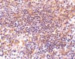 PAK2 Antibody in Immunohistochemistry (Paraffin) (IHC (P))