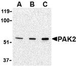 PAK2 Antibody in Western Blot (WB)