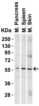 PAK2 Antibody in Western Blot (WB)