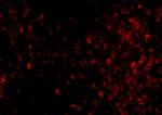 TRPC6 Antibody in Immunocytochemistry (ICC/IF)