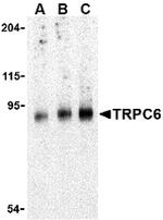 TRPC6 Antibody in Western Blot (WB)