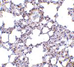 TRPC6 Antibody in Immunohistochemistry (IHC)