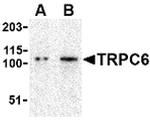 TRPC6 Antibody in Western Blot (WB)