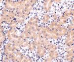 BCL2A1 Antibody in Immunohistochemistry (IHC)