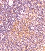 TANK Antibody in Immunohistochemistry (IHC)