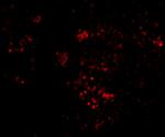 PAK2 Antibody in Immunocytochemistry (ICC/IF)