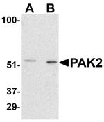 PAK2 Antibody in Western Blot (WB)