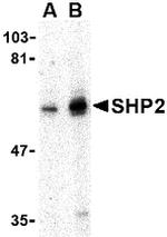 SHP2 Antibody in Western Blot (WB)