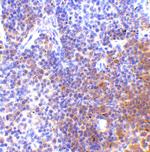 IRF7 Antibody in Immunohistochemistry (IHC)